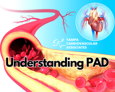 Understanding PAD West florida Vascular and VEin