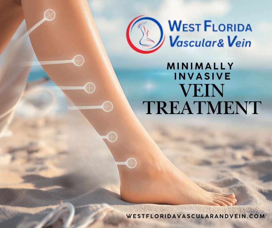 Minimally Invasive vein treatment tampa safety harbor