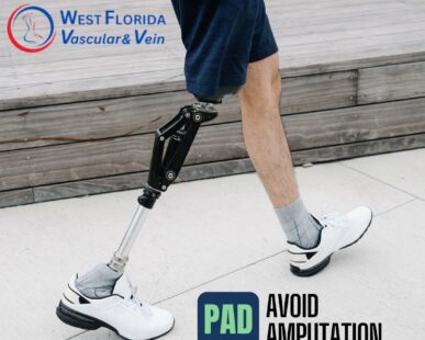 West florida vascular and vein Avoid Amputation due to PAD in Tampa and Safety Harbor