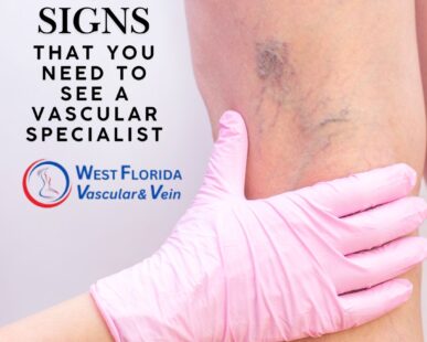 Top Signs You Need to See a Vascular Specialist