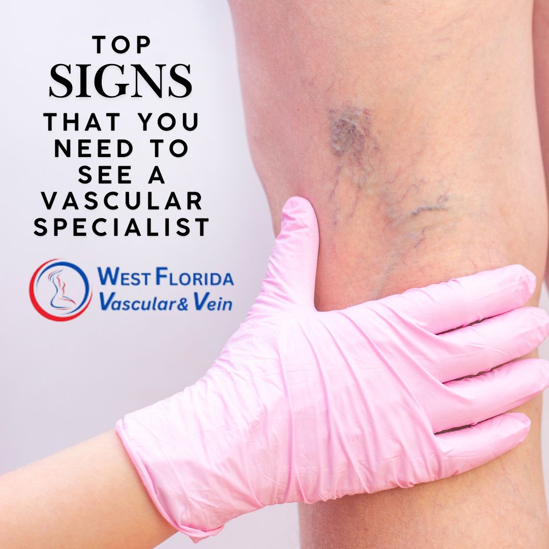 Top Signs You Need to See a Vascular Specialist