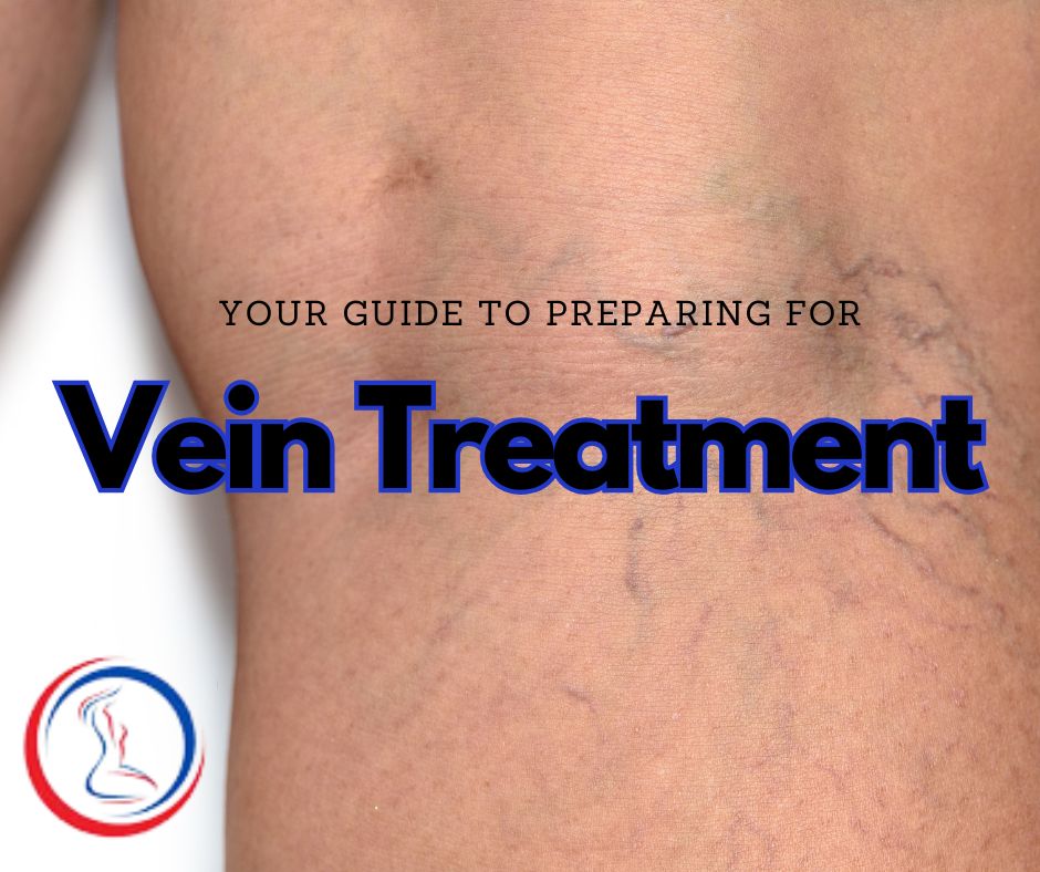 Your Guide to Preparing for a Vein Treatment Appointment