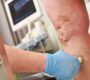 a phlebologist does an ultrasound of the veins of 2025 01 09 01 23 33 utc min 90x80