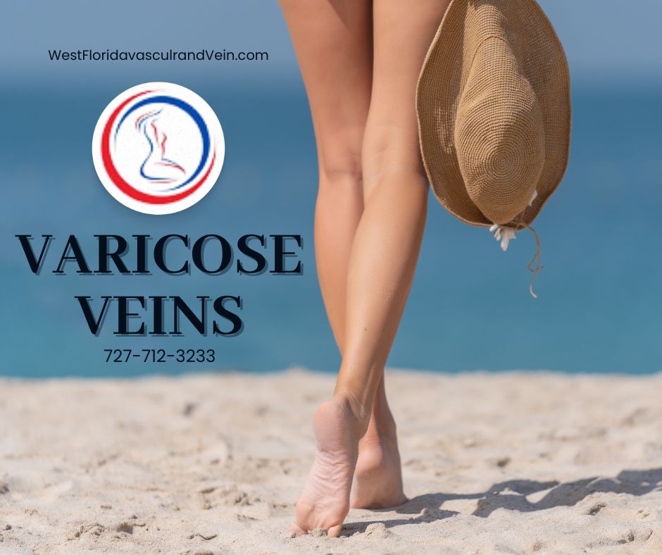 Stop procrastinating - take care of your varicose veins today in tampa and safety Harbor Florida. West Florida Vascular and vein