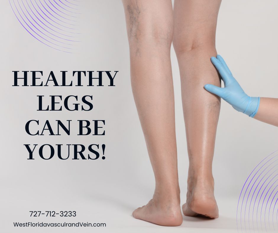 Why Vascular Health Matters After 40: Tips to Keep Your Circulation Strong in Tampa and Safety Harbor