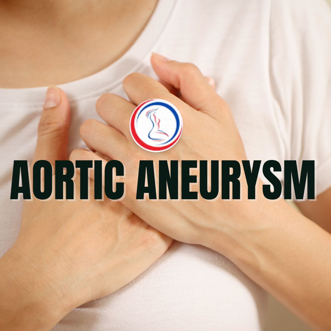 Aortic aneurysm tampa safety harbor