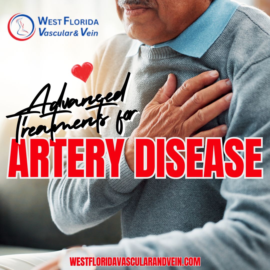 Advanced Treatments Are Changing the Outlook for Artery Disease Patients. West florida vascular and vein Dr zuzga