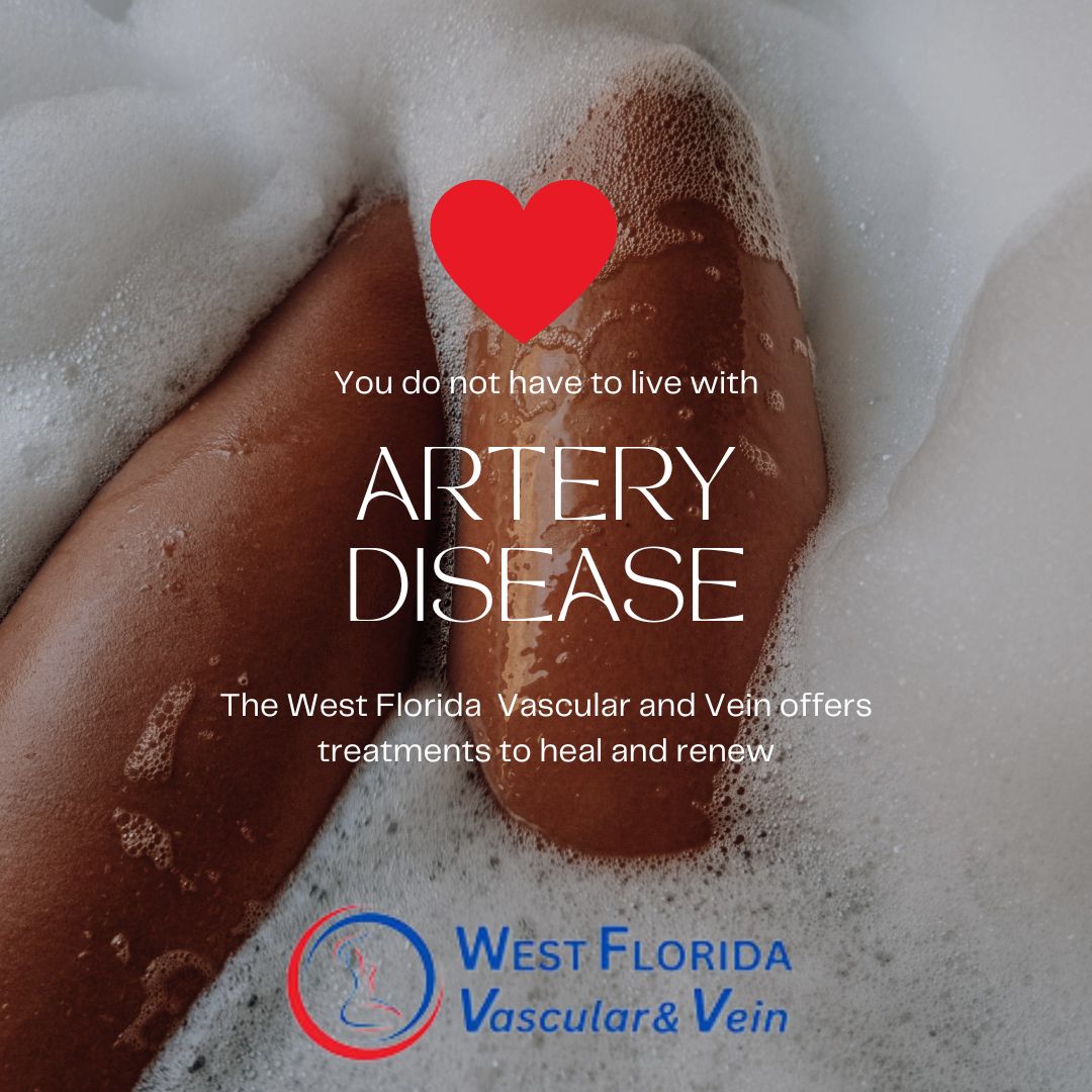 artery disease treatment tampa and safety harbor florida West Florida vascular and vein