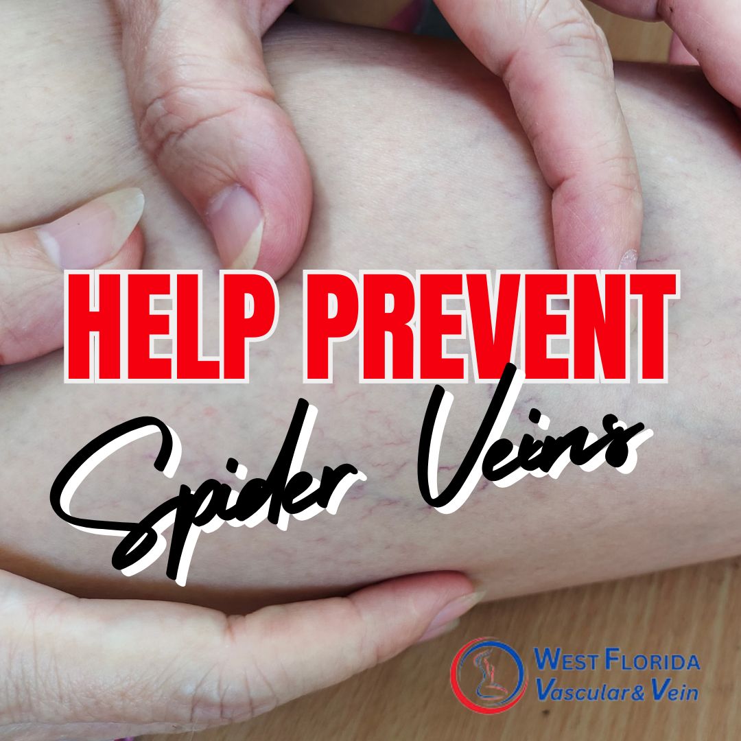 Spider vein treatment tampa and safety harbor florida