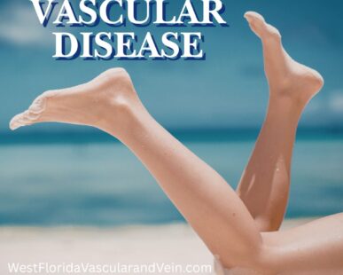 Carotid Artery Disease Treatments