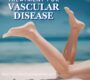 What Is Vascular Disease Common Conditions Treated by Vascular Specialists 90x80
