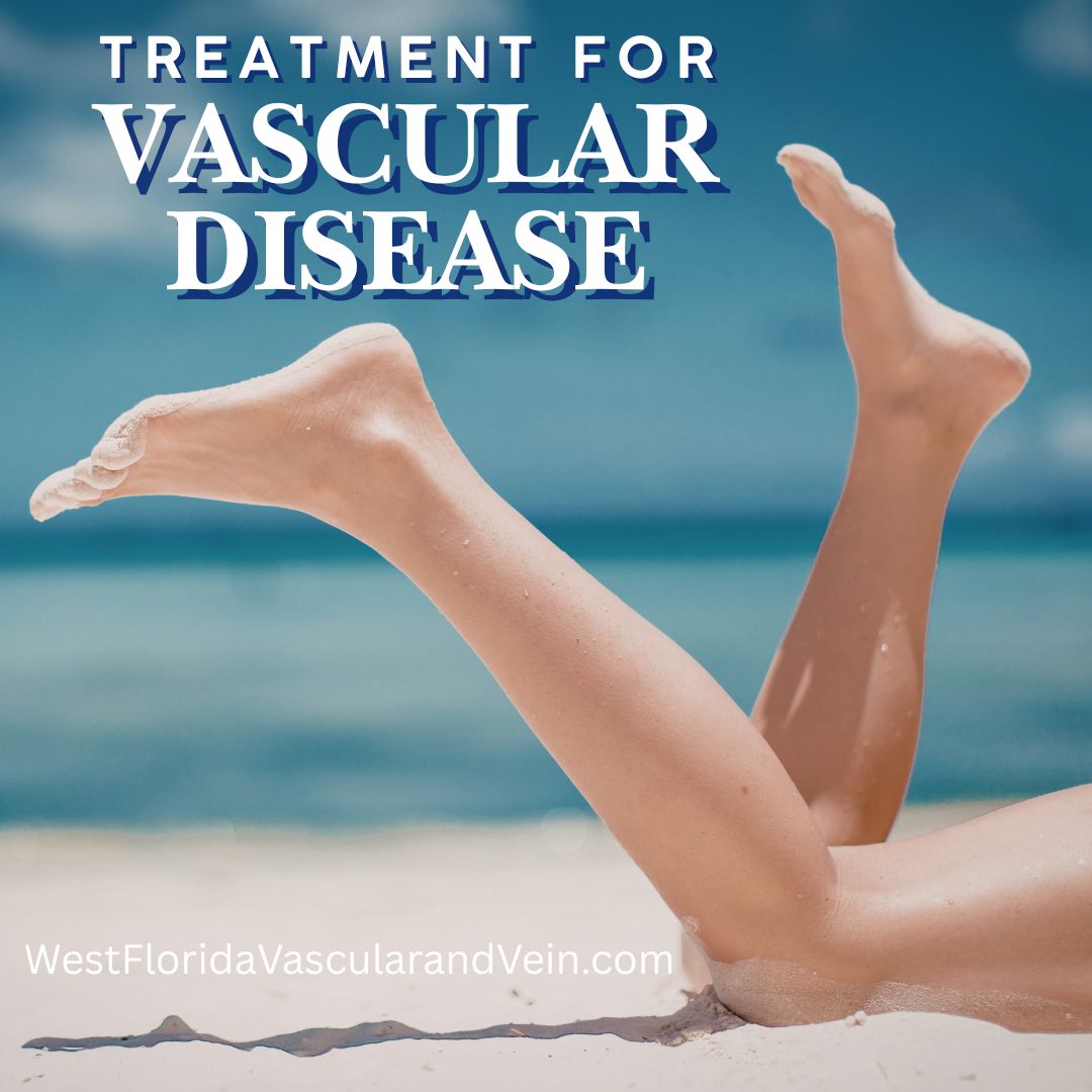 Carotid Artery Disease Treatments