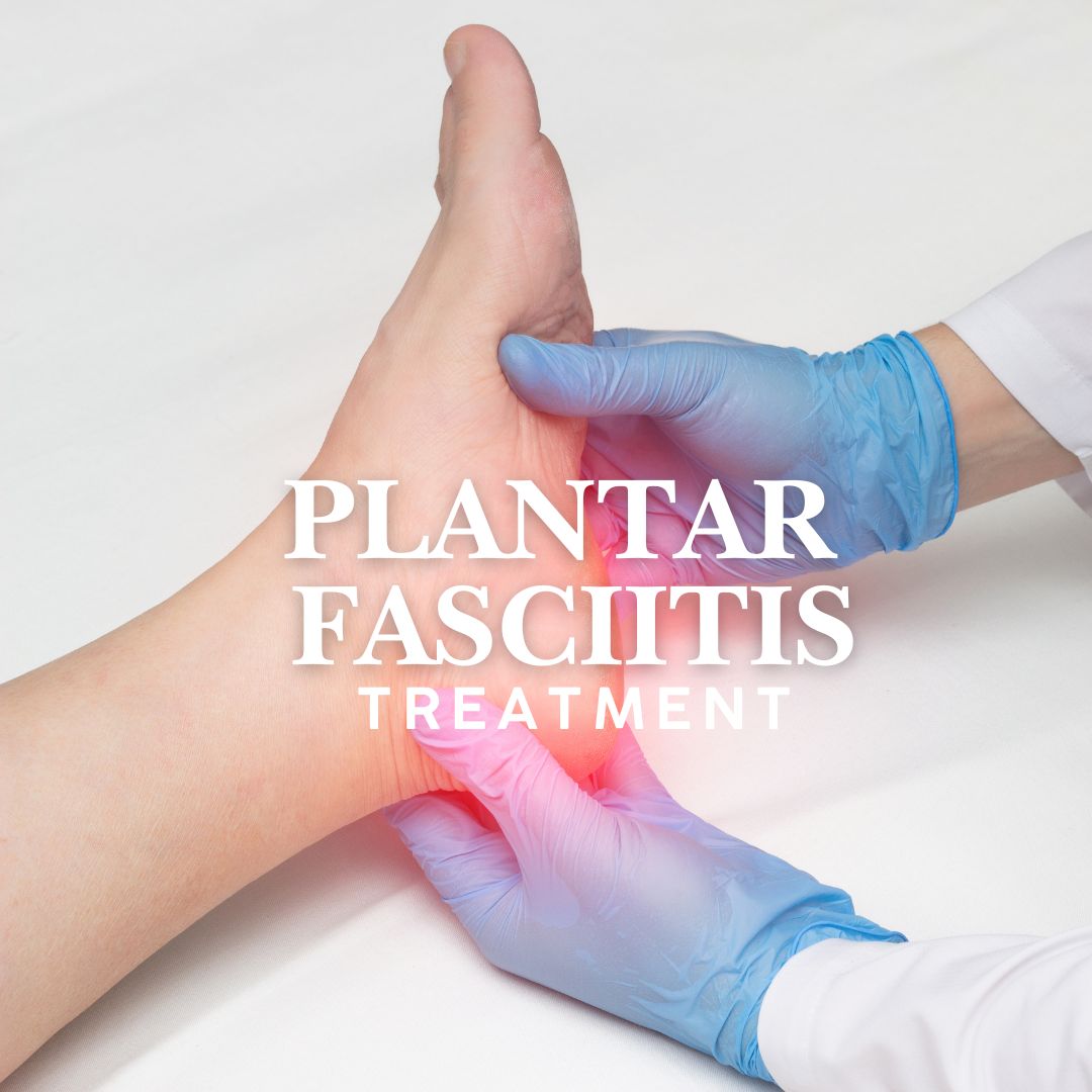 Chronic heel pain plantar fasciitis West florida vascular and vein dr. zuzga