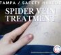 Say goodbye to spider veins safety harbor florida vein treatments west florida vascular and vein 90x80