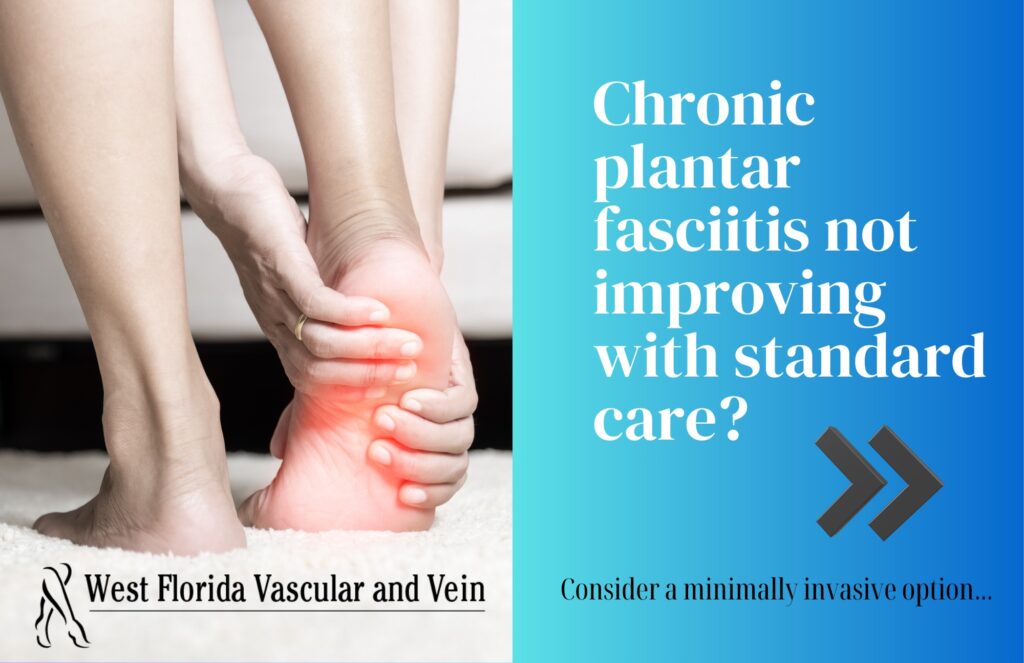 Tampa Plantar Fasciitis Doctor | Tampa Plantar Fasciitis Treatment Procedure Center