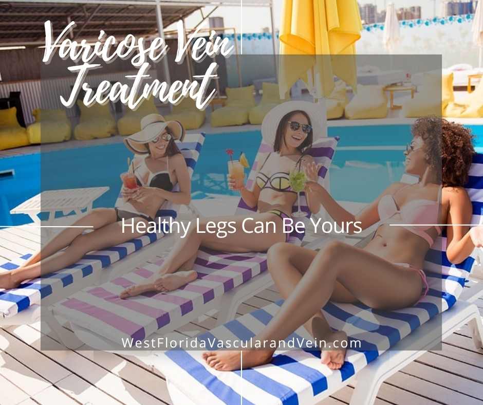 Varicose Vein Treatment in Safety Harbor & Tampa