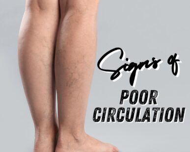 signs of poor circulation west florida vascular and vein