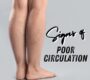 signs of poor circulation west florida vascular and vein 90x80