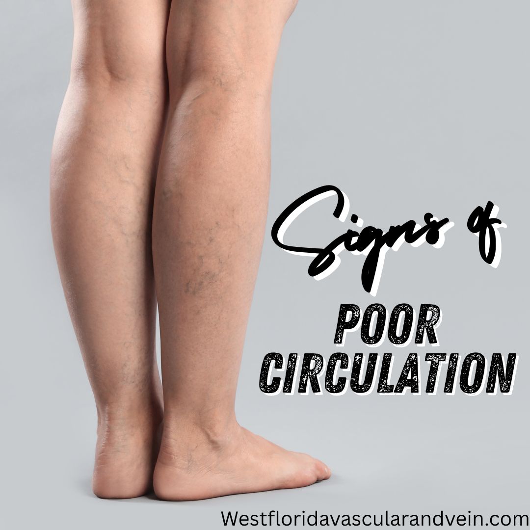signs of poor circulation west florida vascular and vein