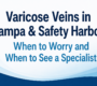 vein issues tampa and safety harbor treatment dr. zuzga 90x80