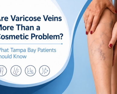 west florida vascular and vein varicose veins
