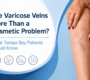 west florida vascular and vein varicose veins 90x80