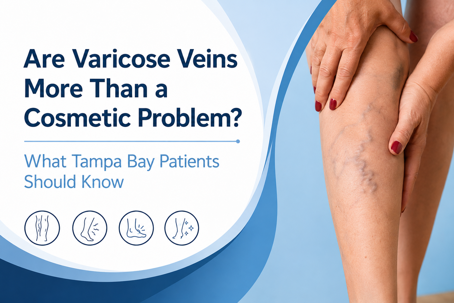 west florida vascular and vein varicose veins